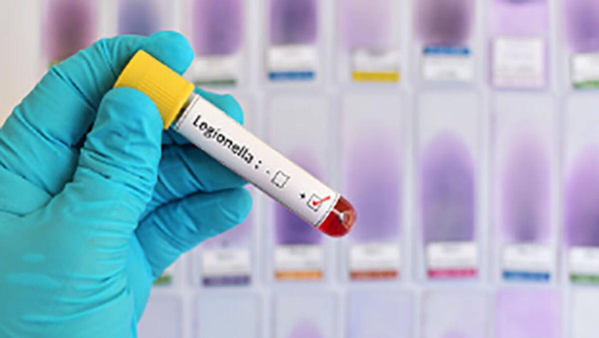 Allarme legionella in Campania: altri tre casi dopo la donna morta - 