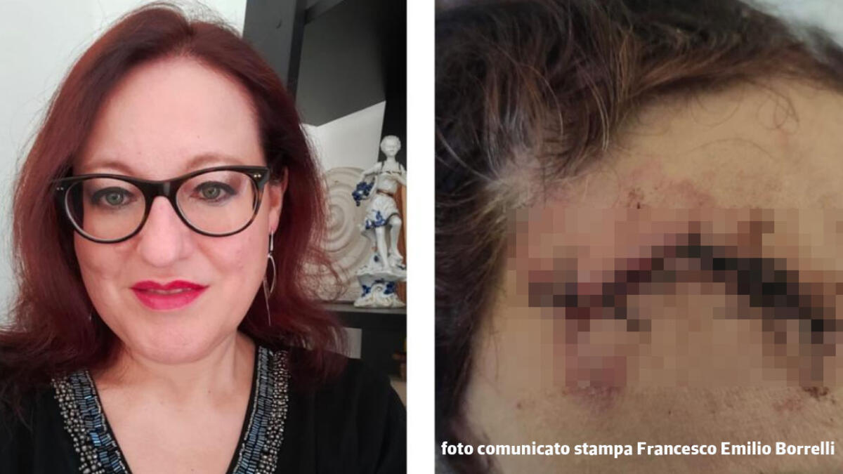 Trasportano scala sullo scooter, donna resta colpita alla testa mentre passeggia - 