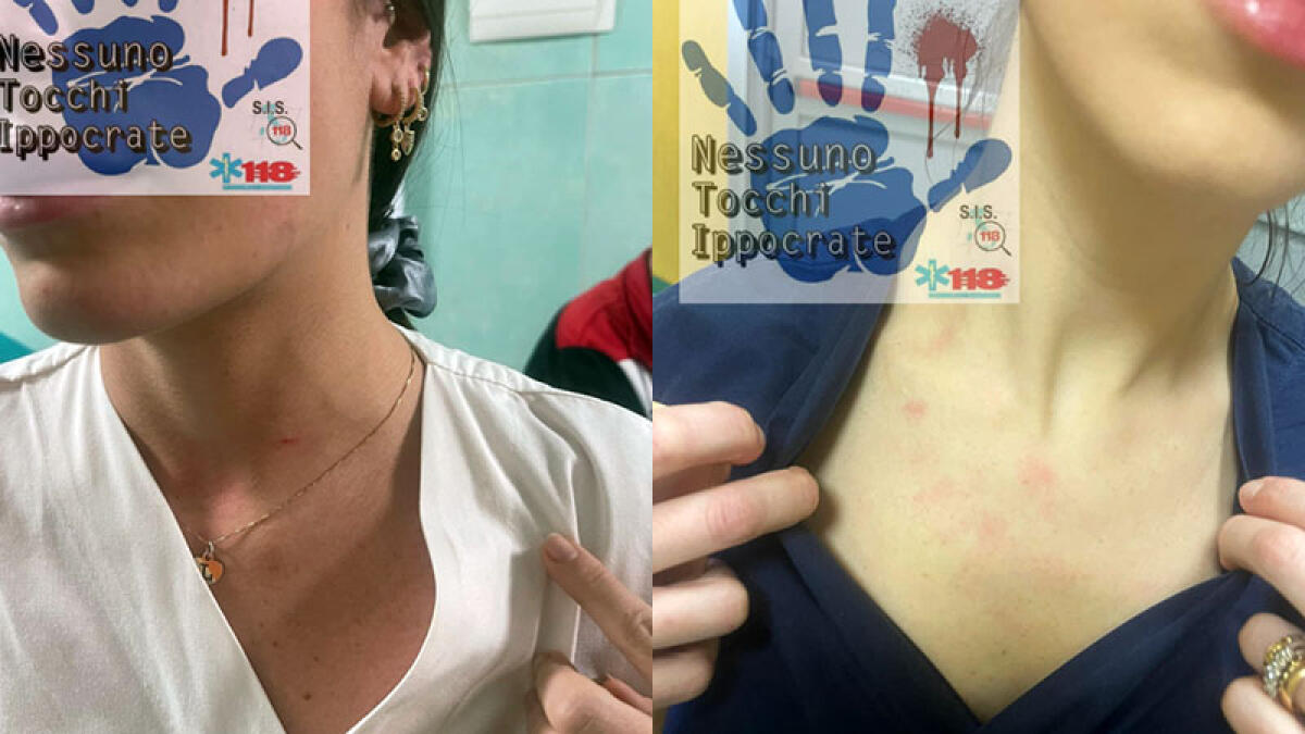 Santobono, due aggressioni in due giorni: "Siamo esausti" - 