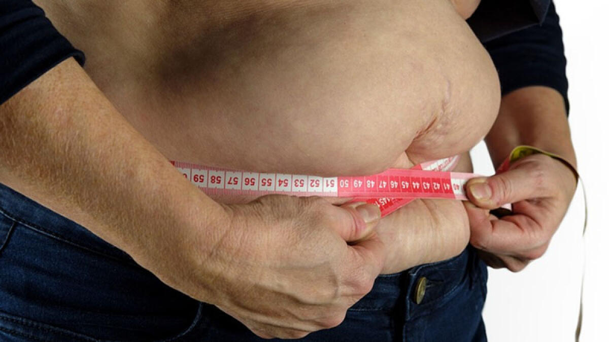Obesità, uomini più a rischio a causa degli ormoni: ora possono cambiare le cure - 
