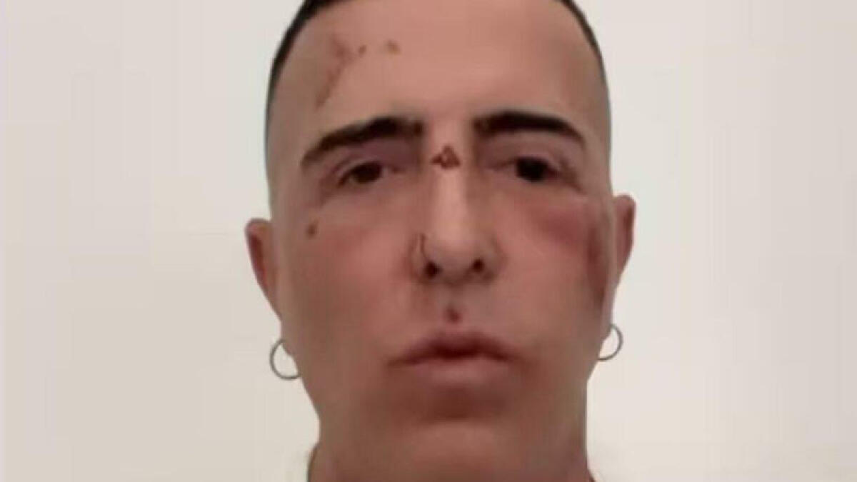 Ferito in incidente, Franco Ricciardi rinvia il concerto - 