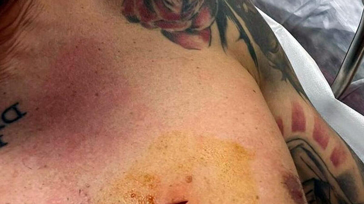 Accoltellato davanti allo stadio: "Voleva passare con l'auto tra la folla" - 