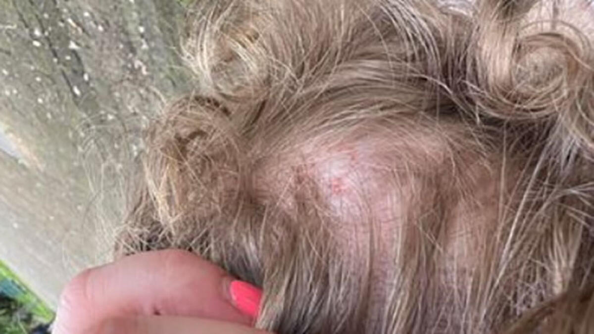 Bimba di 21 mesi cade con la mamma dallo scivolo in Villa Comunale e si ferisce - 