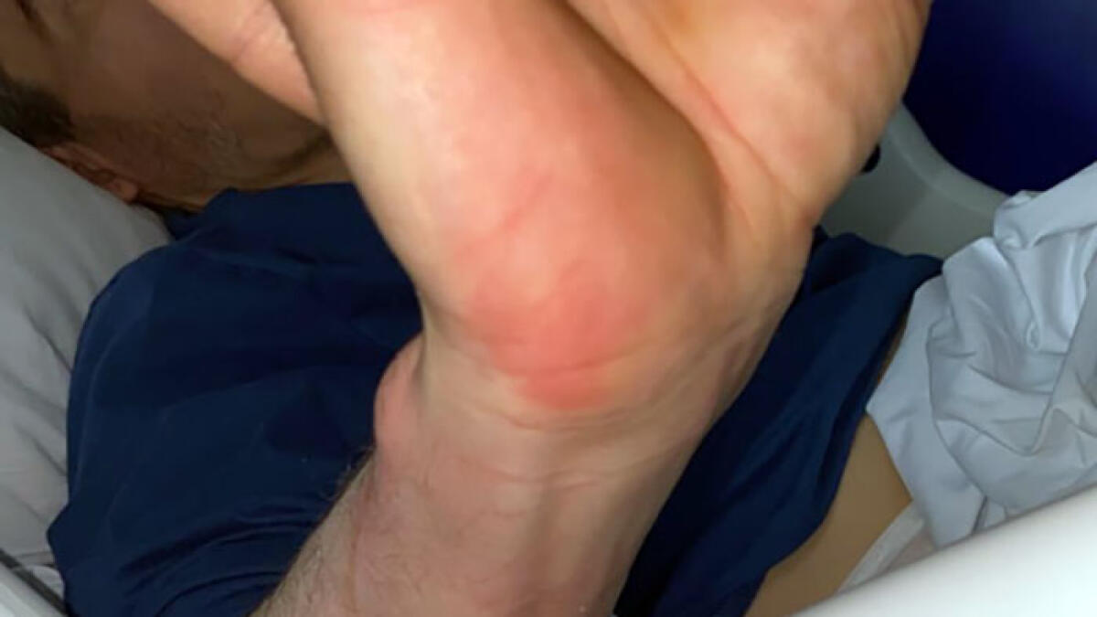 "Violenze su paziente d'igiene mentale, gamba rotta e lividi su corpo e volto" - 