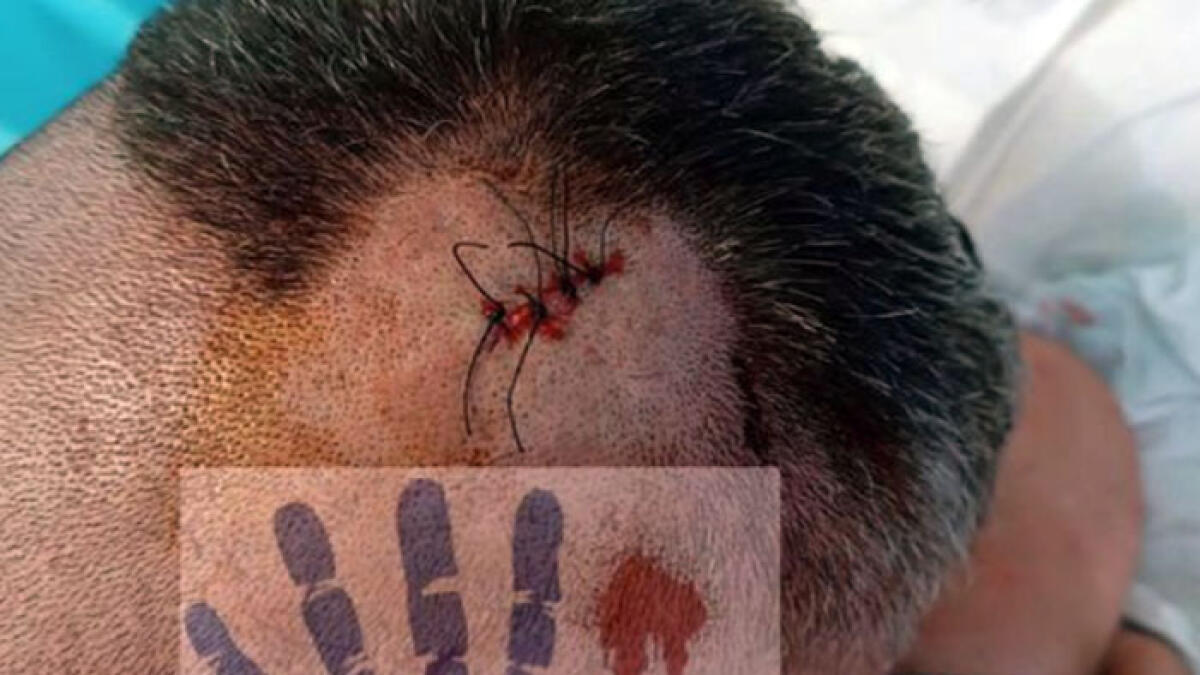 Guardia giurata presa a bastonate in testa al pronto soccorso - 