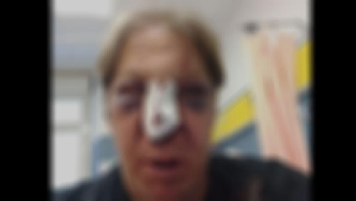 Giornalista pestato alla serata con Rita De Crescenzo - 