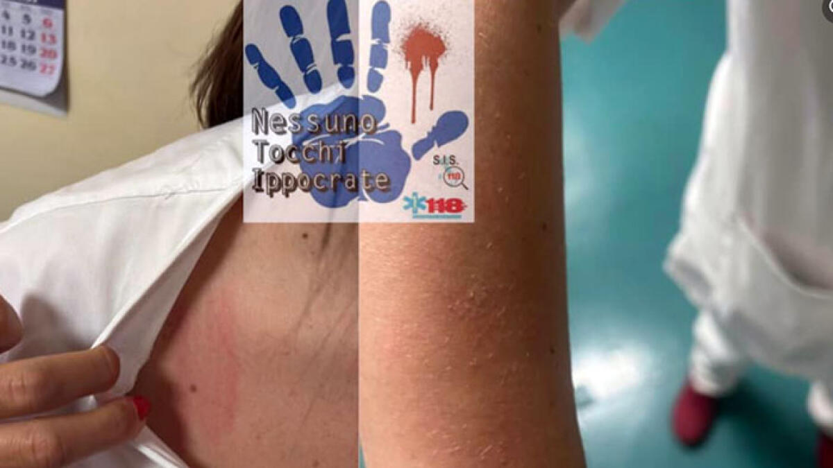 Donna arriva con il Covid in ospedale, tossisce in faccia a tutti e picchia infermiera - 