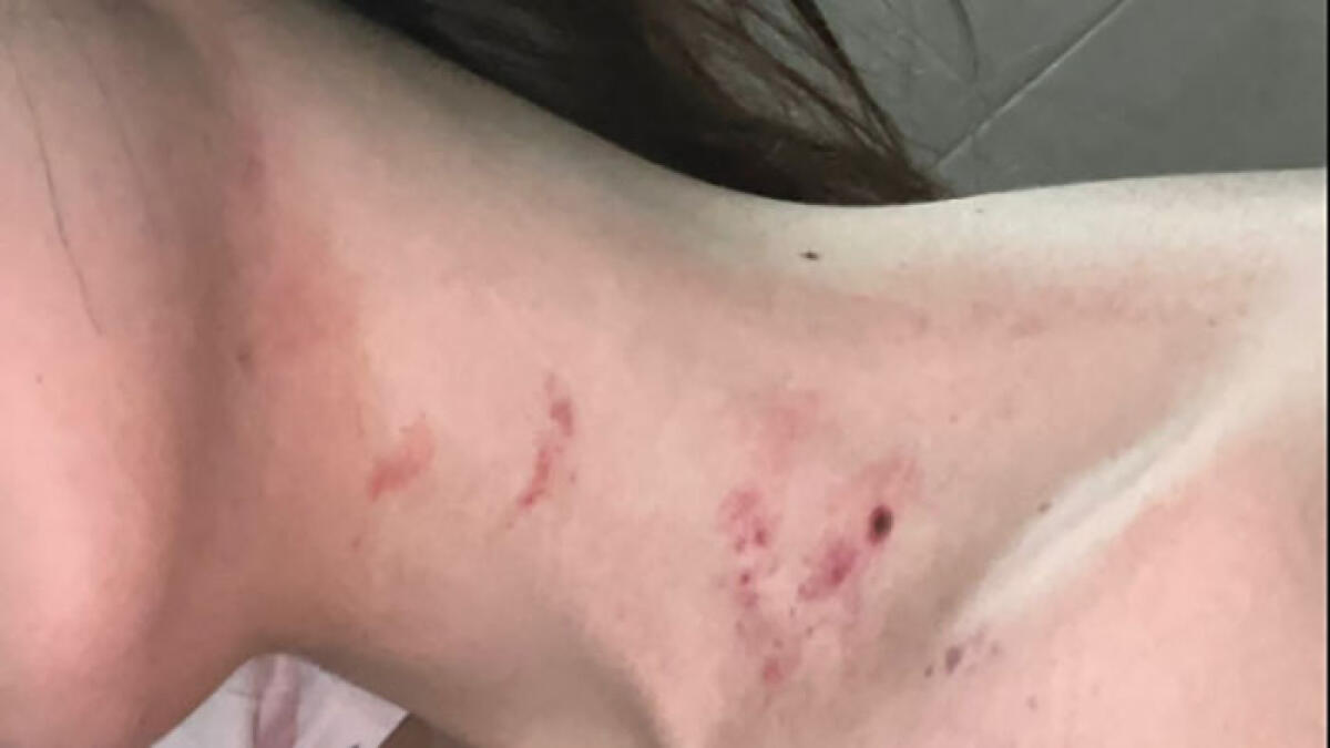 Ragazza napoletana picchiata e strangolata al Nord dal fidanzato - 