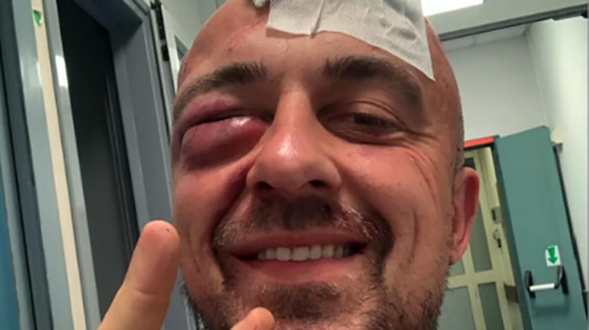 Chef Rubio pestato in strada - 