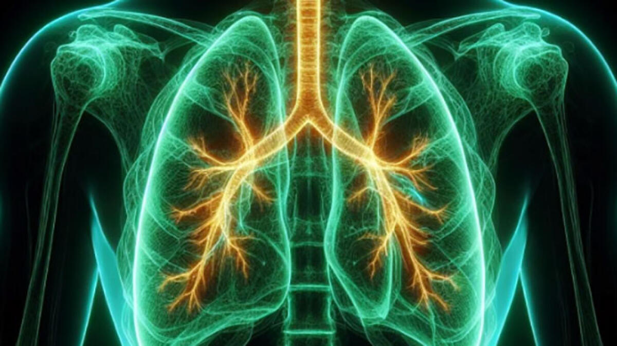 Nuova terapia per il tumore al polmone: rischio di morte ridotto dell'84% - 