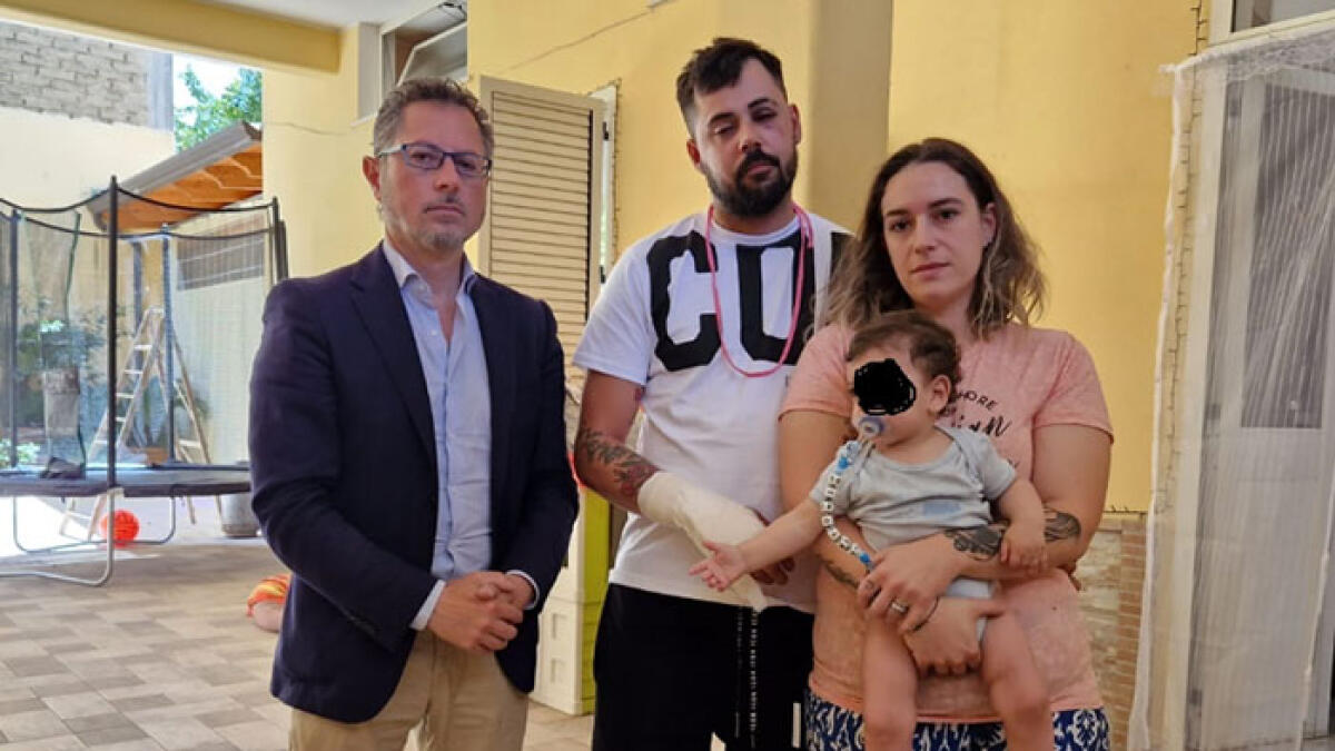 Pestato dal parcheggiatore abusivo, amputato un dito - 