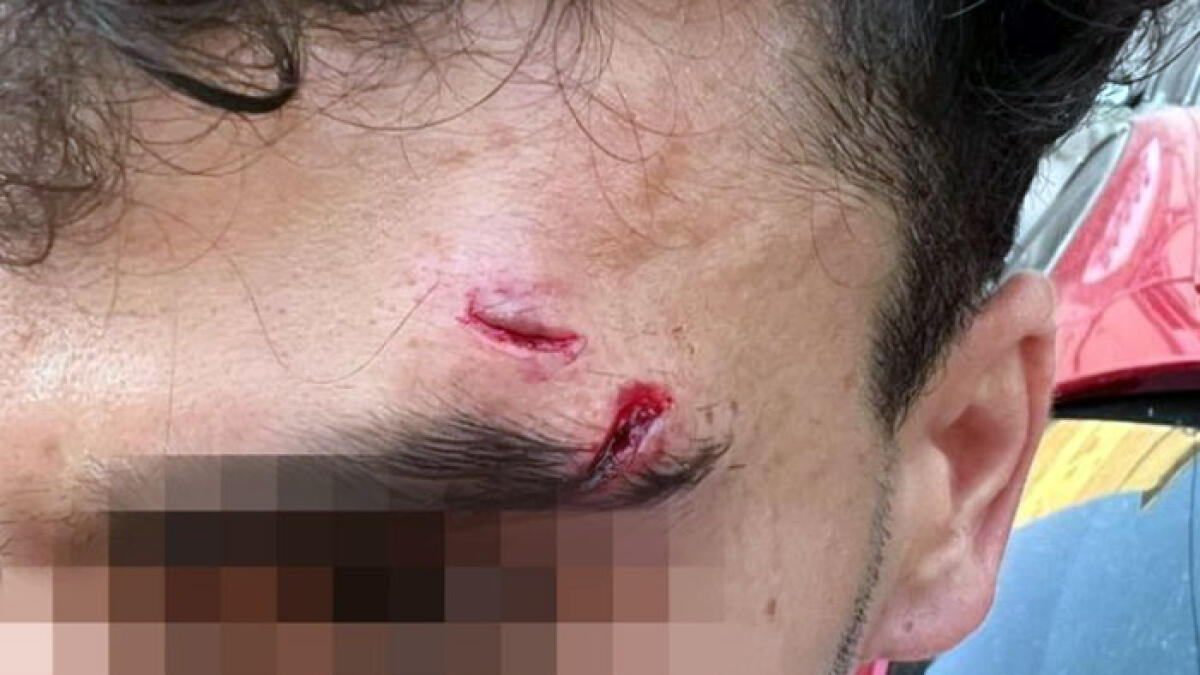 Pestato con una pistola per una banale lite nel traffico - 