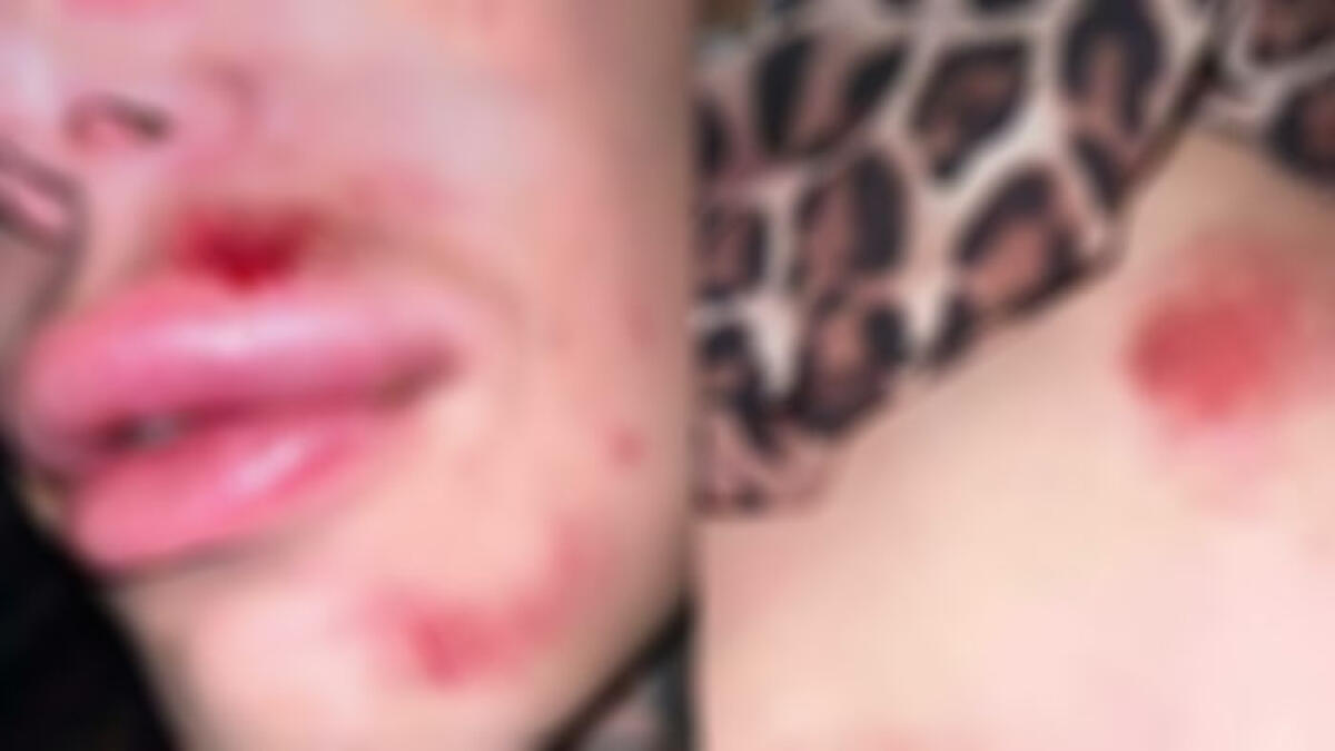 "Fate ribrezzo", due ragazze trans pestate dal branco alla Festa del Vino - 