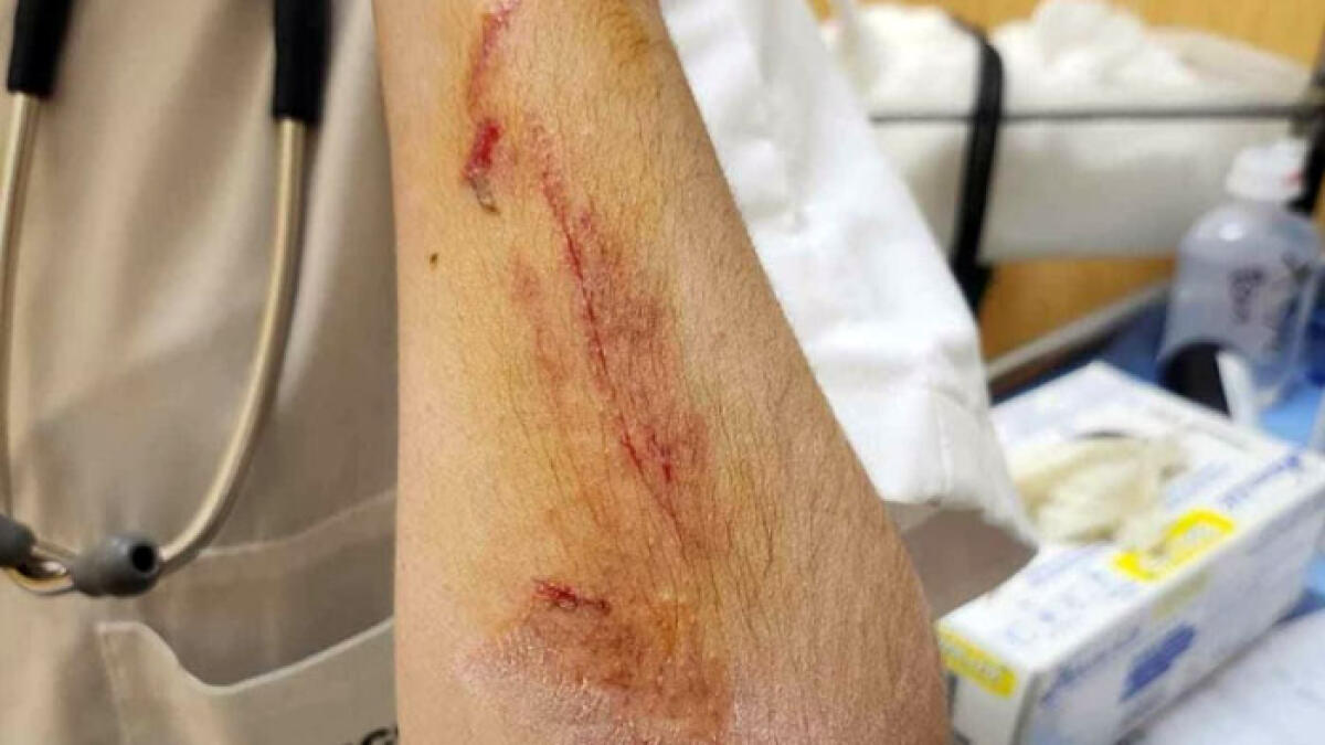 La dottoressa ferita: "Non voglio tornare al pronto soccorso" - 