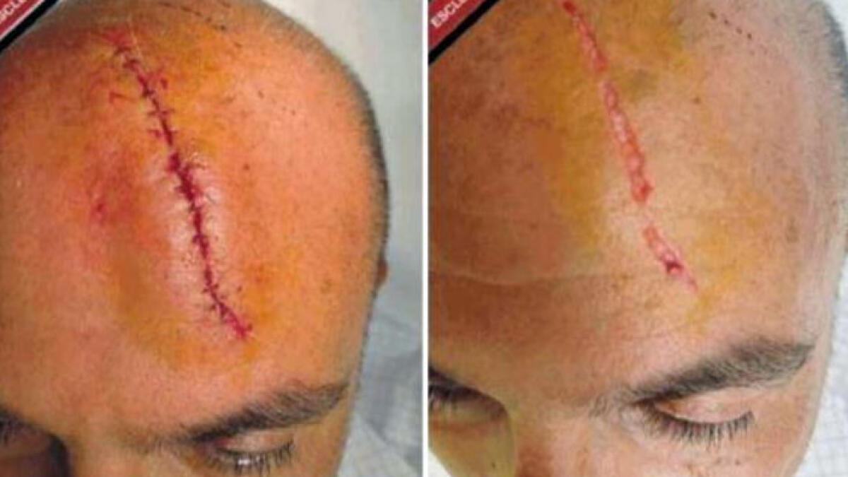 La foto di Sangiuliano: l'aggressione di Maria Rosaria Bocca gli sarebbe costata 13 punti - 