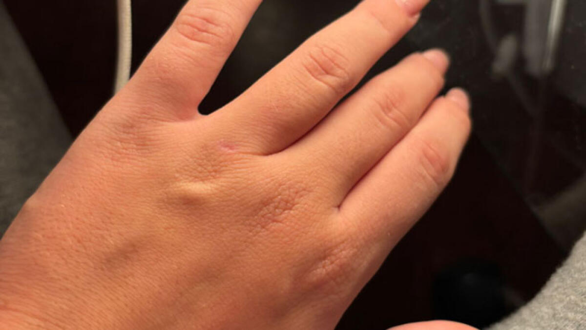 Ragazzina di 13 anni presa a schiaffi da un uomo al concerto di Geolier - 