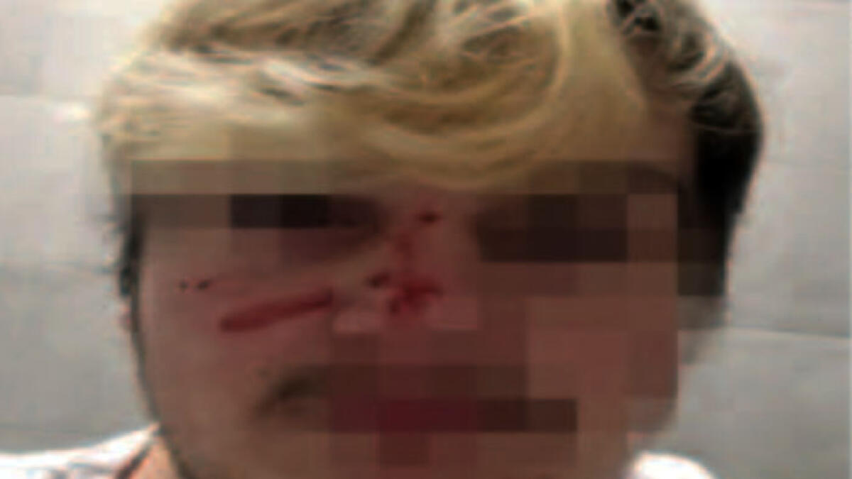 Pestato per una precedenza in strada - 