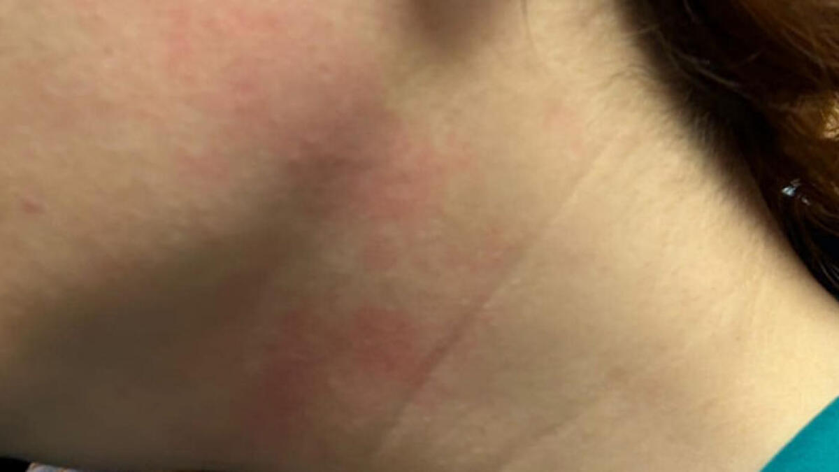 Stop alle violenze, negli ospedali arriva il comunicatore anti-aggressioni - 