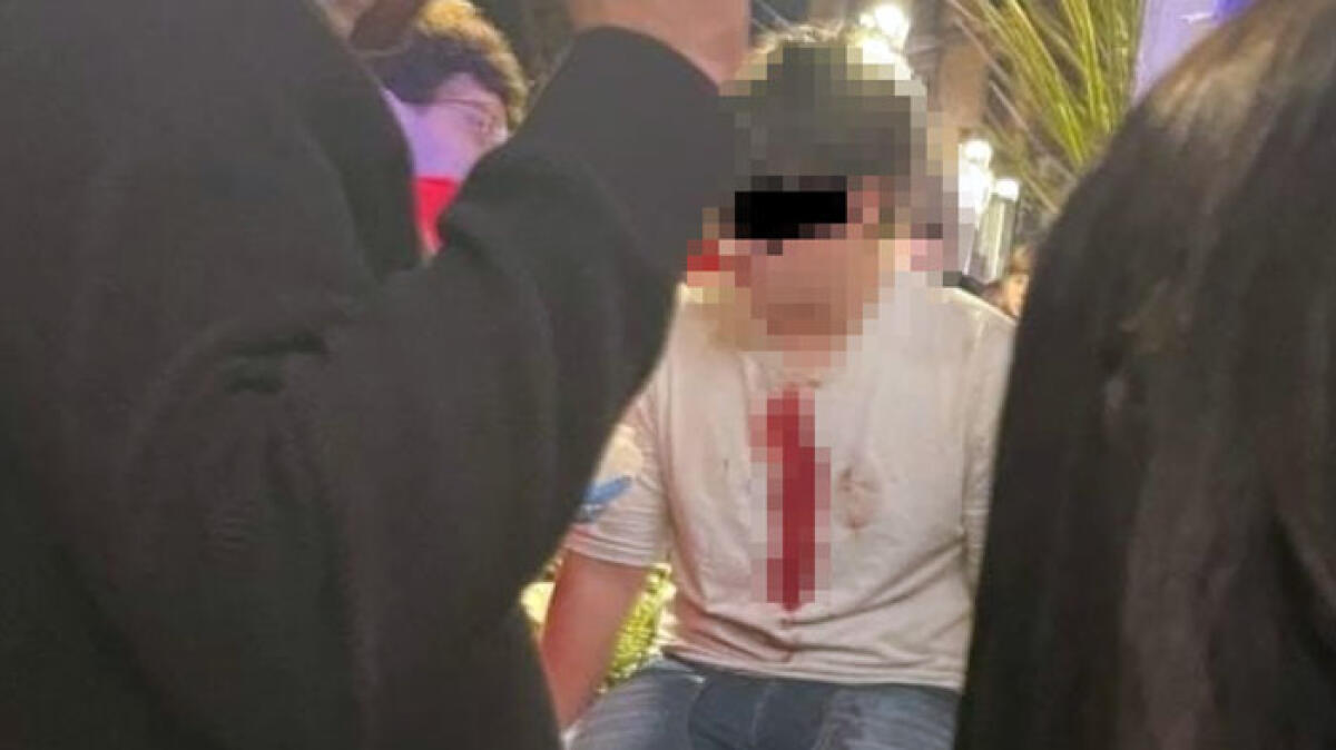 Ragazzino mascherato da dinosauro per divertirsi con gli amici: lo accoltellano - 