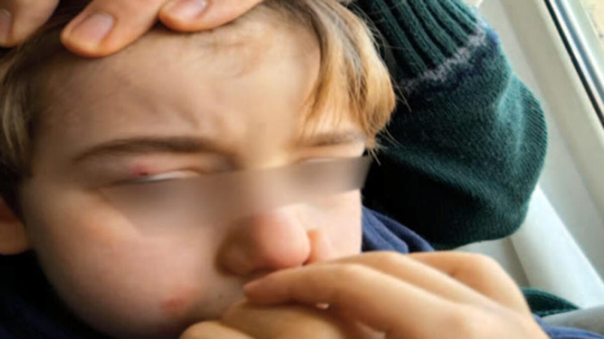 Bimbo travolto sul marciapiede da uno scooter - 