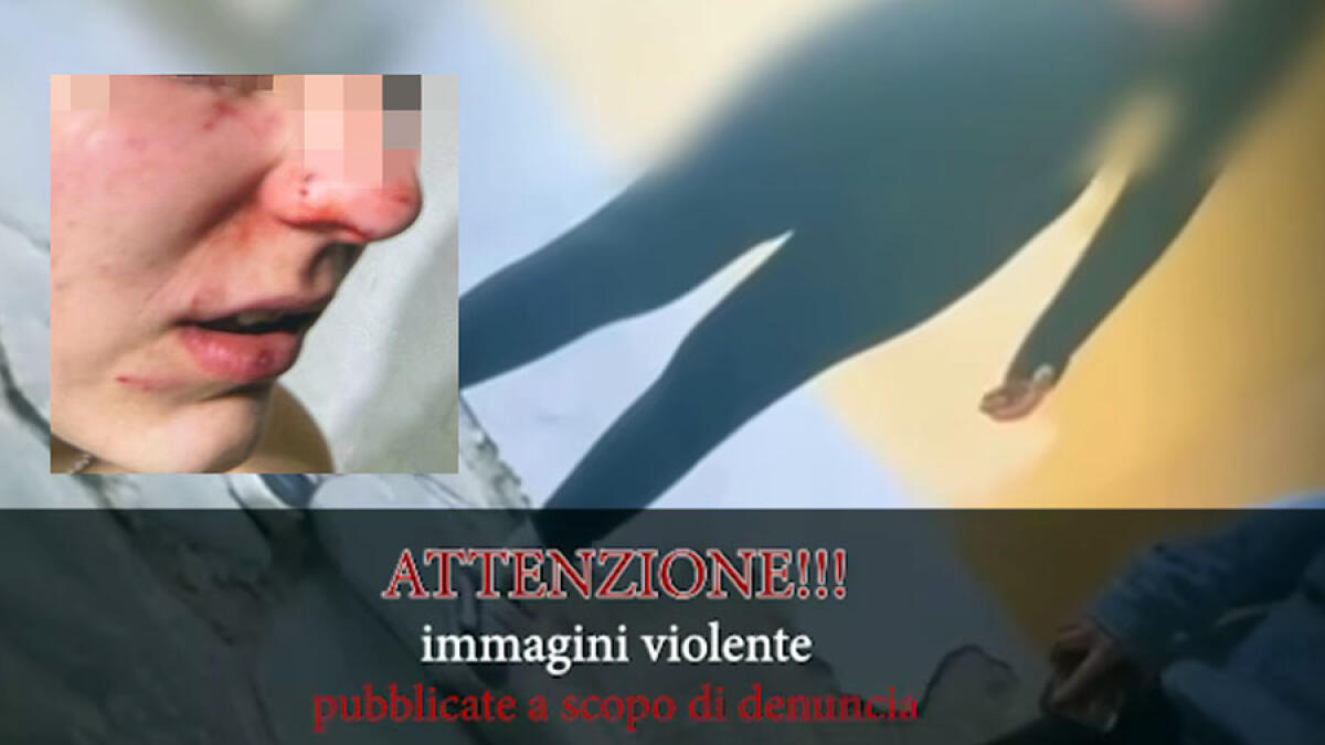 Le "amiche" le tendono un agguato e girano il video: ragazzina sfregiata al volto - 