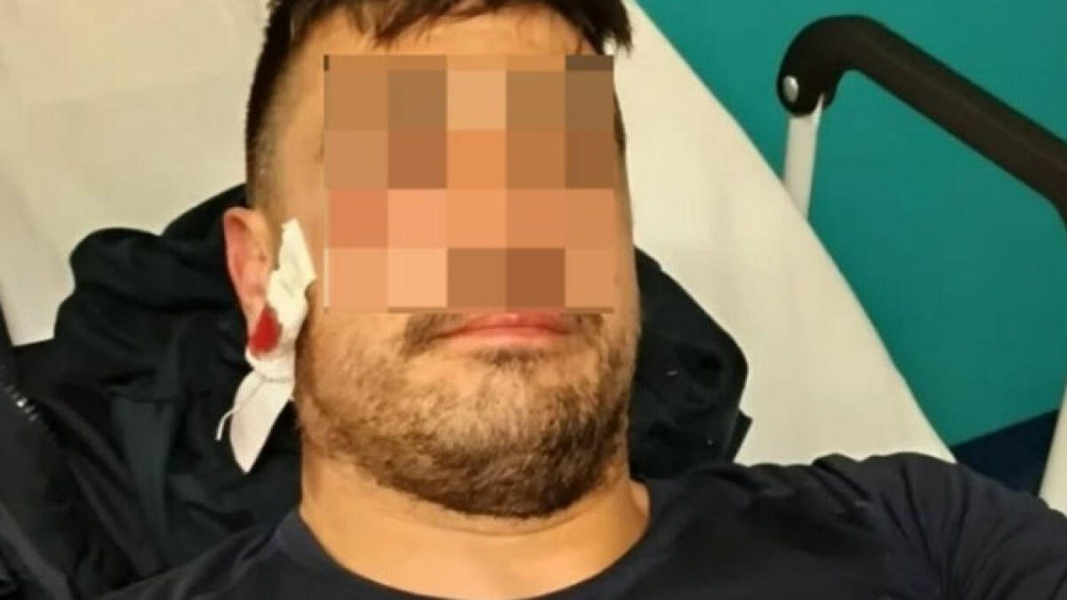 Agente penitenziario picchiato con una bombola d'ossigeno da tre detenuti - 