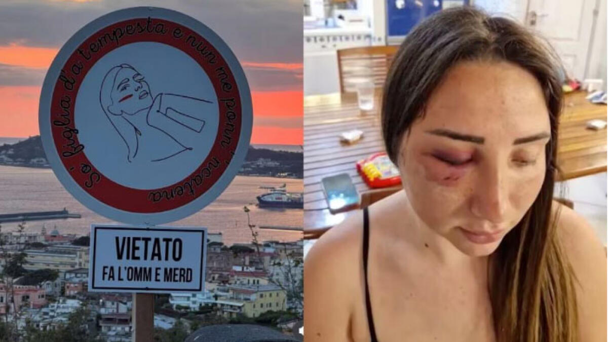 "Vietato fa l'omm' e m...", spunta cartello nel luogo dell'aggressione a Gaia - 