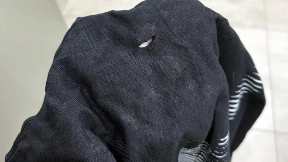 Minorenne accoltellato ad un polmone per uno sguardo di troppo - 