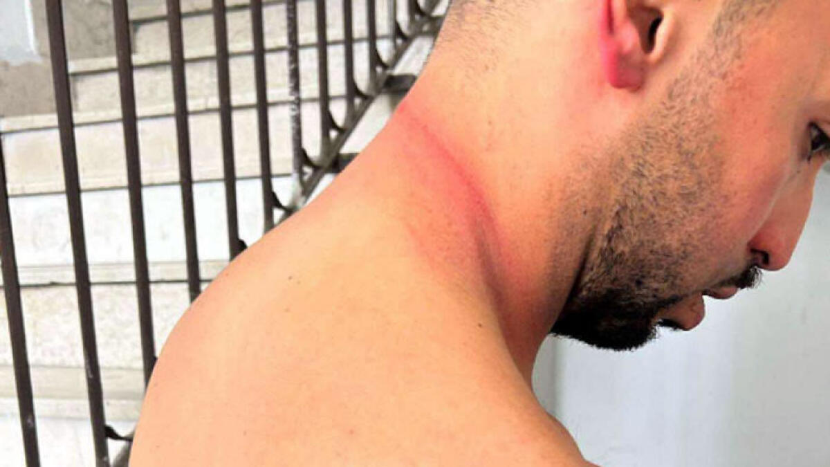 Operatori del 118 aggrediti dal paziente - 