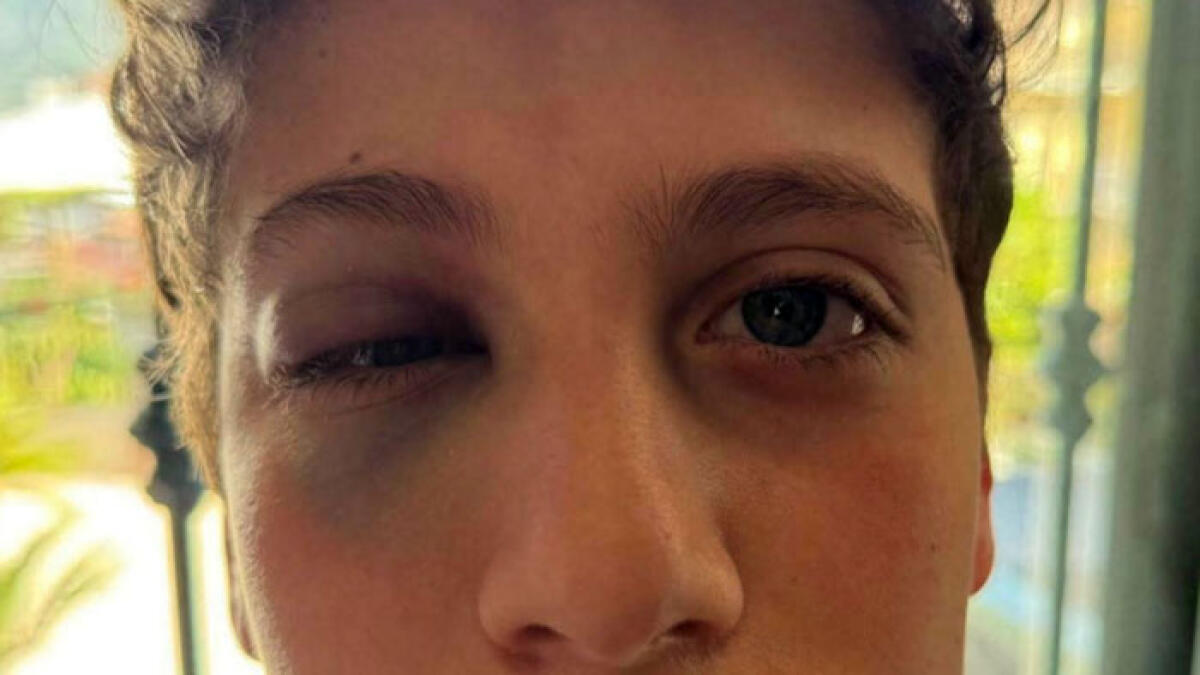 Picchiato senza motivo in pizzeria - 