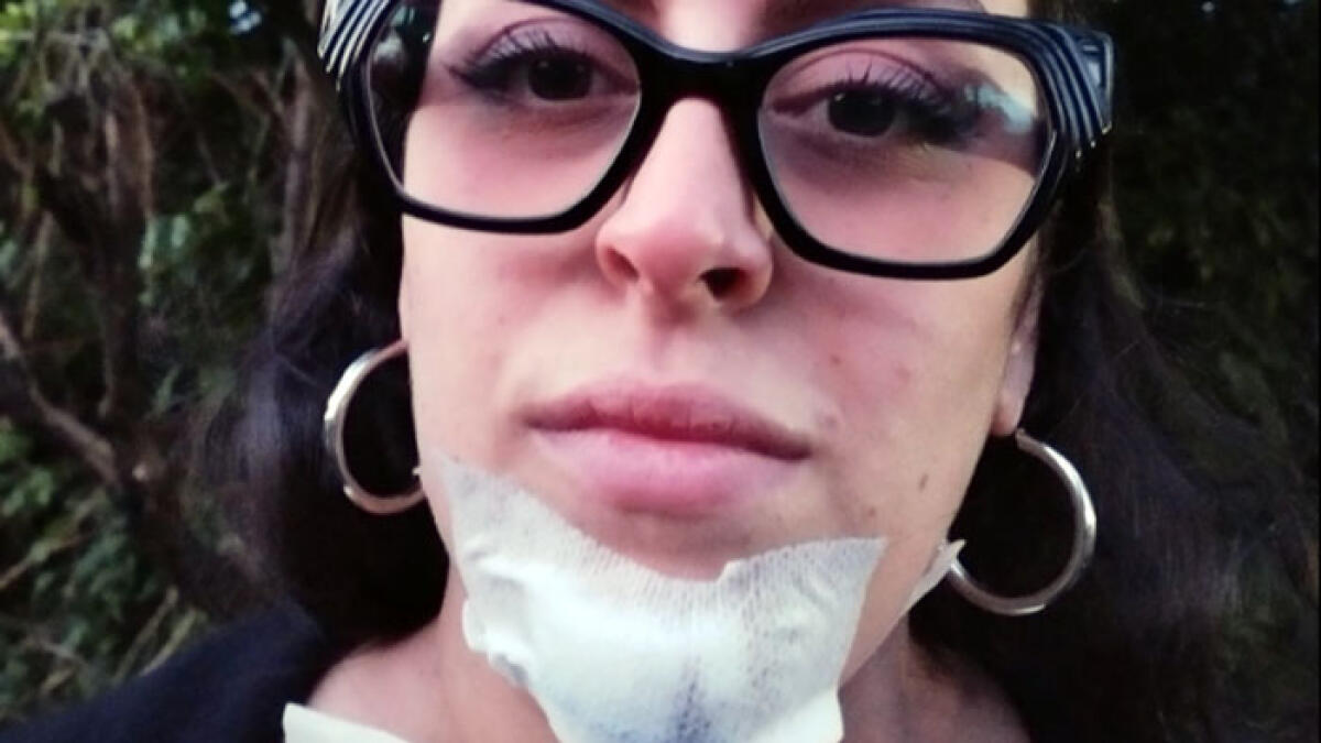 Sabrina ferita dalla sassaiola sulla Statale 268: "Fermiamoli prima che ci scappi il morto" - 