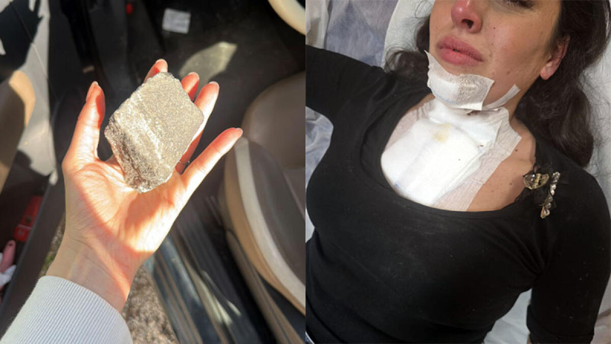 Sassi contro le auto sulla Statale vesuviana, donna ferita e ricoverata - 