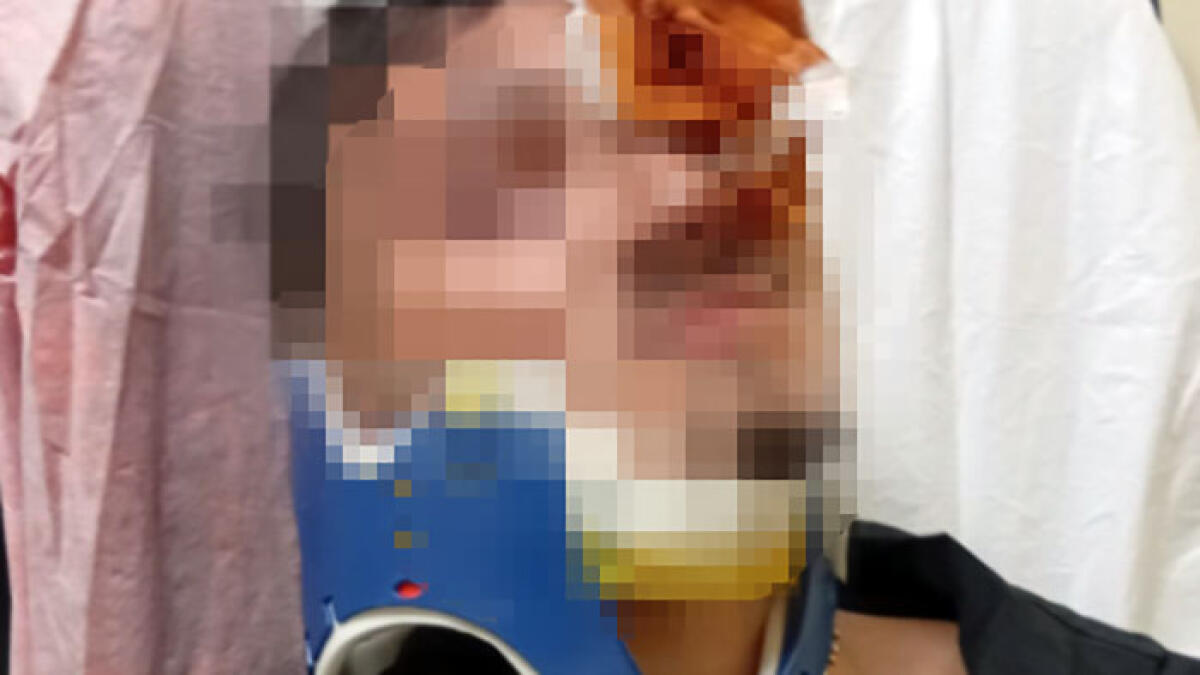 Si limita a salutare una ragazzina, 16enne massacrato di botte al volto - 