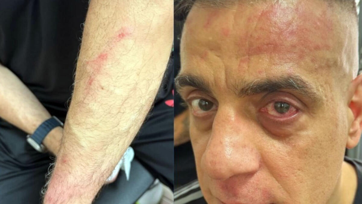 Youtuber picchiato a Piazza Garibaldi: "Qui non devi fare riprese" - 