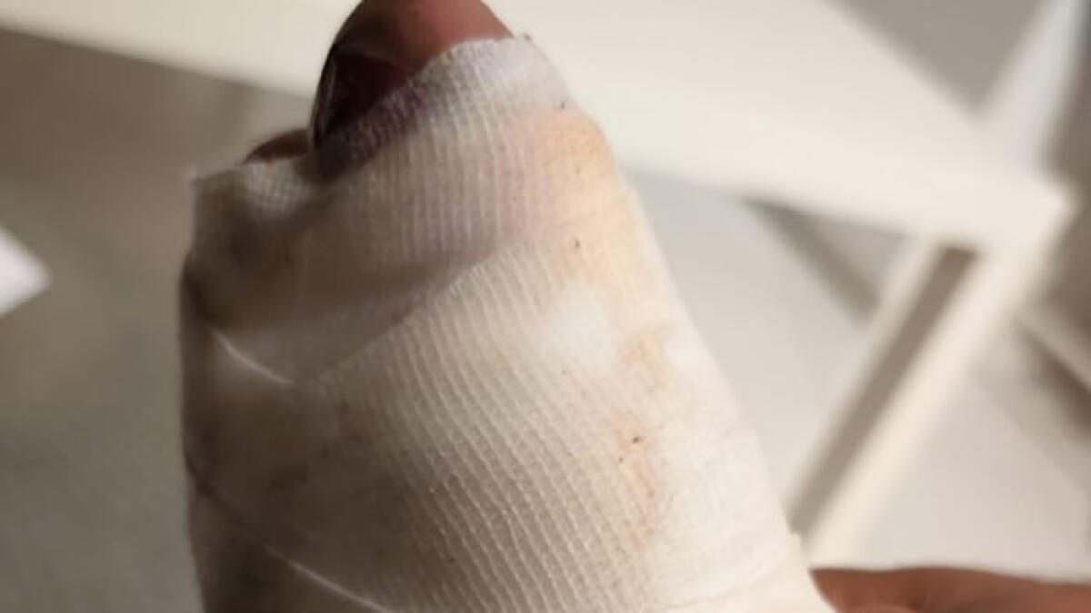 Giornalista filma gli abusivi in spiaggia e finisce ferito a collo e piedi - 