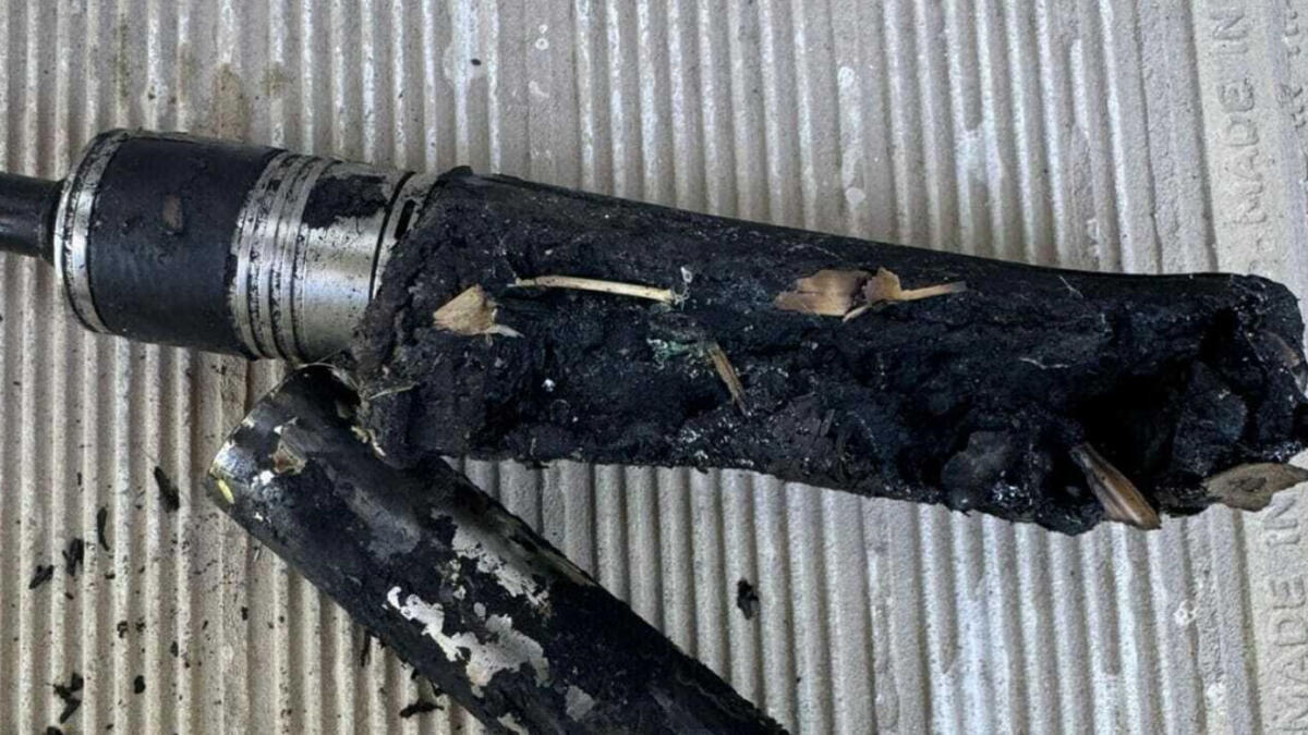 Esplode sigaretta elettronica, 25enne ustionato e con 50 punti di sutura - 