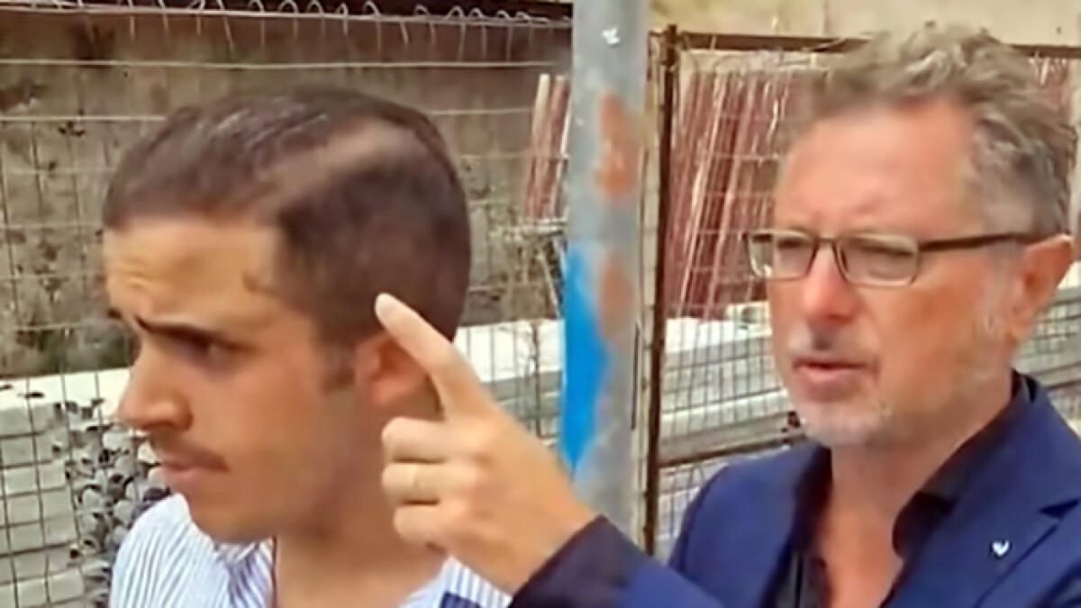 Ottaviano, il ragazzo disabile picchiato esce allo scoperto e mostra le ferite - 