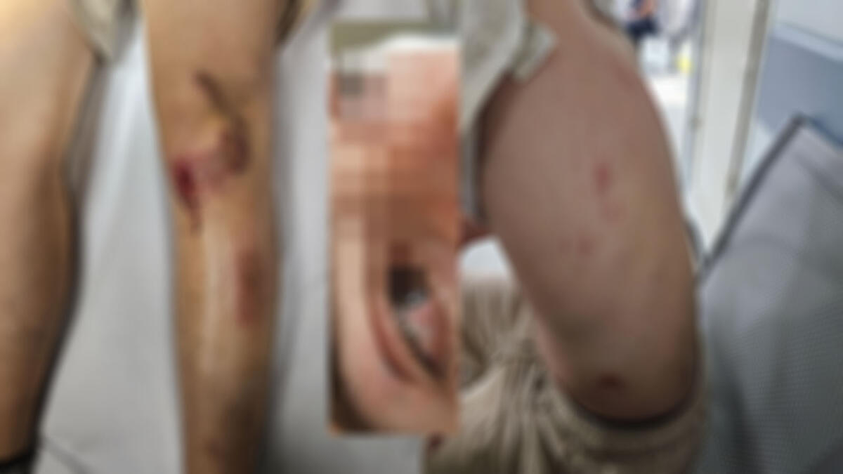 Poggiomarino, 14enne massacrato in centro da tre ragazzi: trauma cranico e ferite su tutto il corpo - 