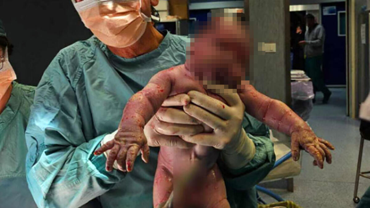 Primo figlio, l'età media per le donne è di 32 anni e mezzo - 