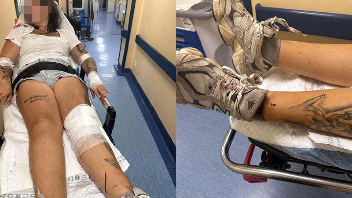 Tre cugine accoltellate dalle zie - 