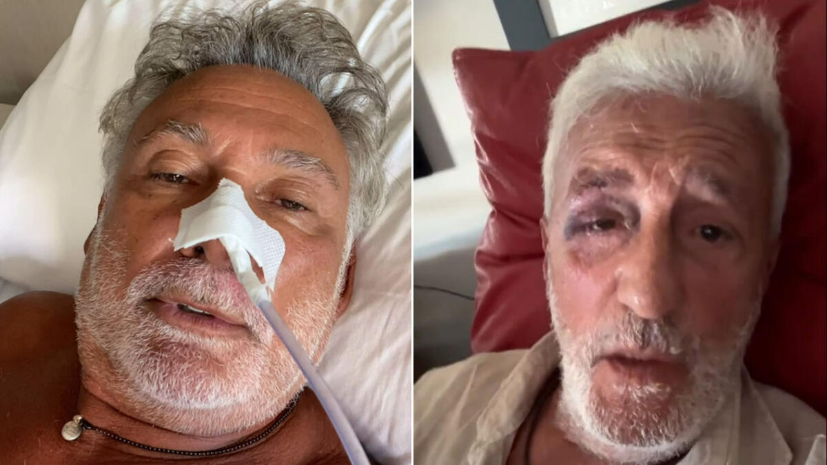 Francesco Paolantoni e Patrizio Rispo ricoverati in ospedale - 