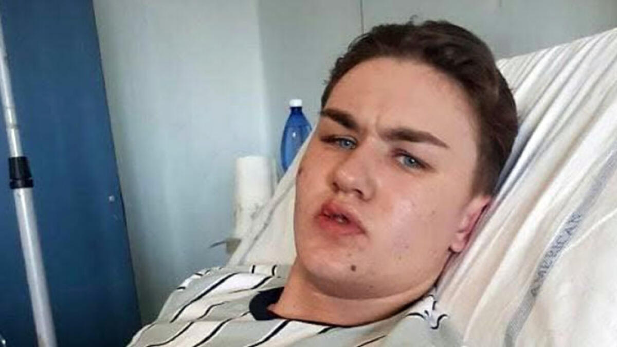 L'attore di Mare Fuori devasta il pronto soccorso - 