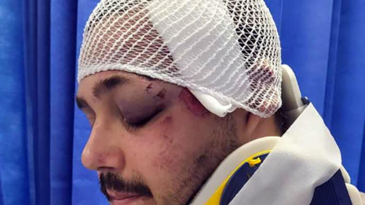 Ciclista investito: ferite al volto e distacco della retina - 