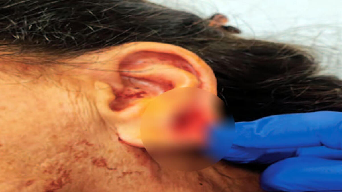 Altra aggressione, ferita da passeggero senza biglietto - 