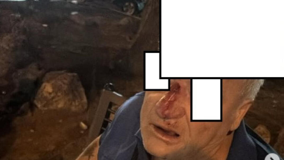 Aggredito e spinto con il volto a terra - 