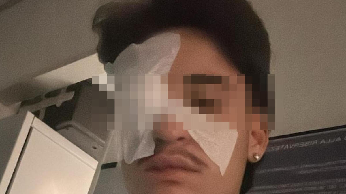 Pallonata involontaria scatena feroce pestaggio - 