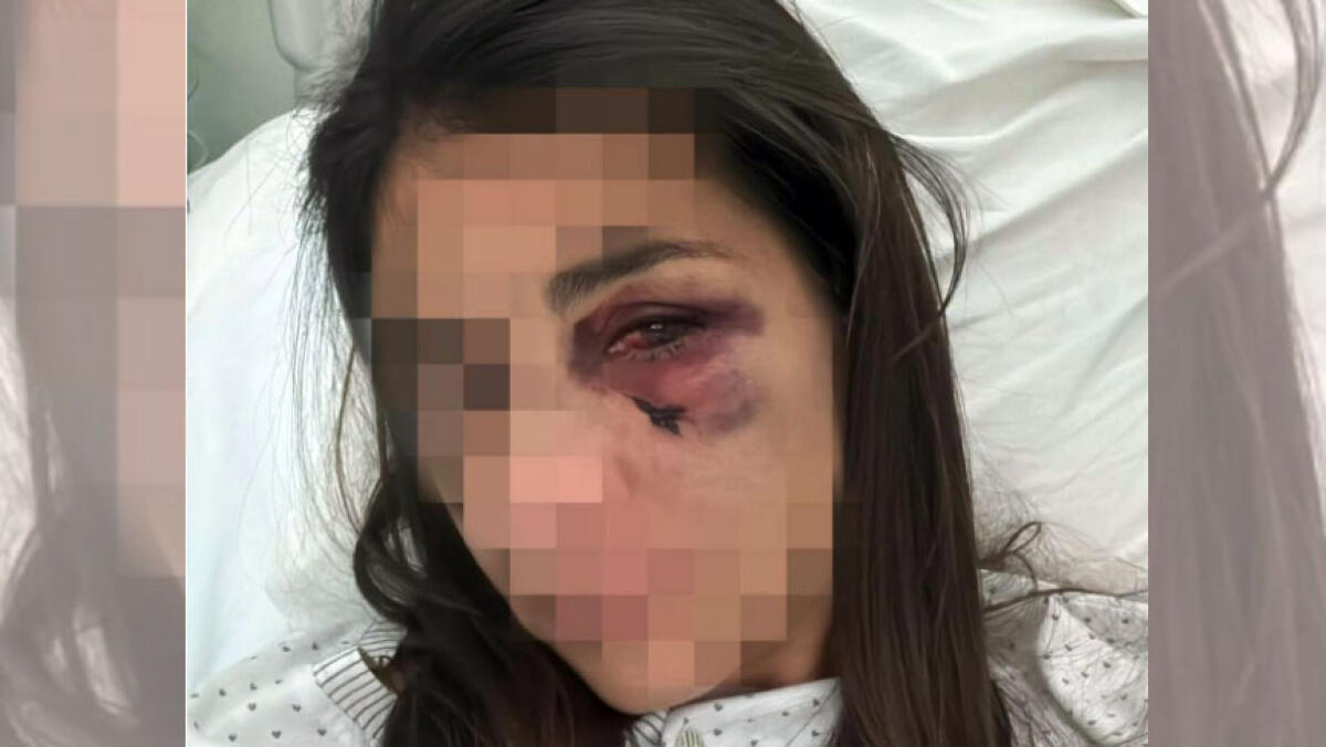 Massacrata dal marito a Sant'Anastasia, lui è totalmente libero - 