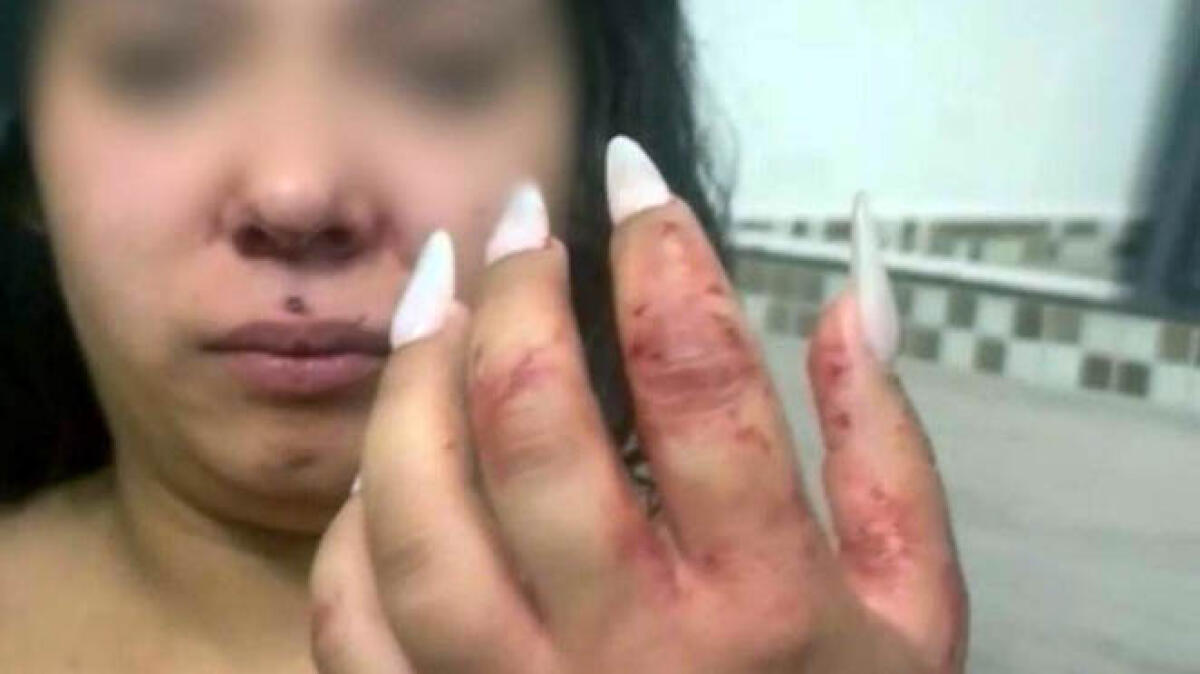 Ragazza di 20 anni picchiata da una mamma gelosa - 