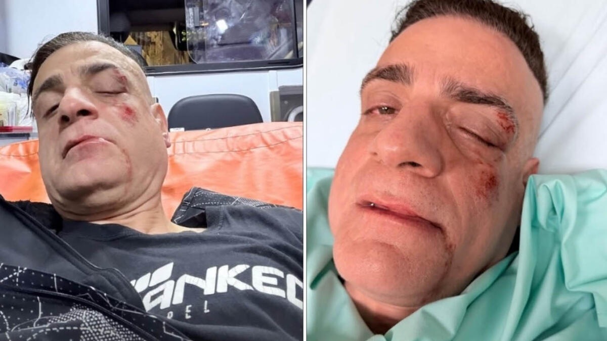 Lo youtuber Cicalone riempito di botte in metropolitana - 