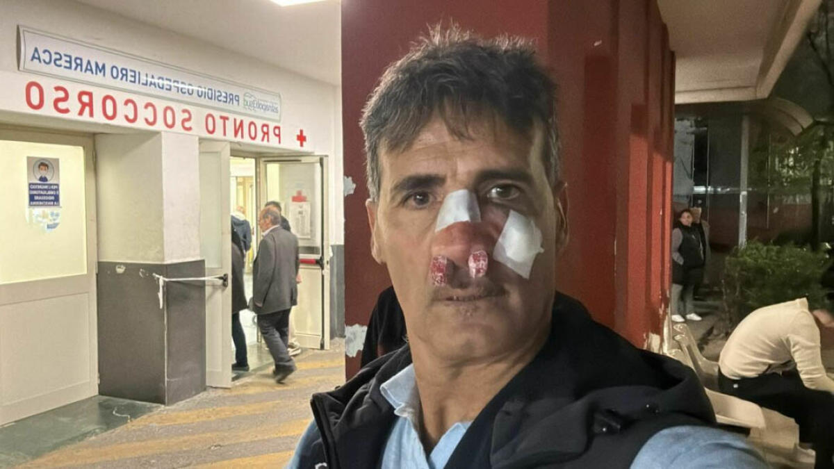 Presidente della Puteolana preso a pugni durante una partita a Torre del Greco - 